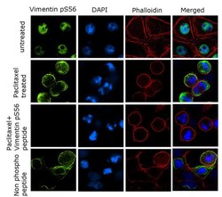 Invitrogen Phospho-Vimentin (Ser56) Recombinant Superclonal Antibody (7HCLC) 100 &mu;g | Buy Online | Invitrogen&trade; | Fisher Scientific
