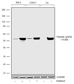 Invitrogen Phospho-Vimentin (Ser56) Recombinant Superclonal Antibody (7HCLC) 100 &mu;g | Buy Online | Invitrogen&trade; | Fisher Scientific