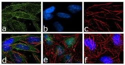 Invitrogen B-Raf Recombinant Superclonal Antibody (7HCLC) 100 &mu;g; Unconjugated:Antibodies,