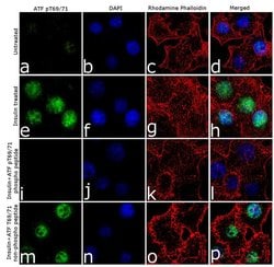 Phospho-ATF2 (Tyr69, Thr71) Recombinant Polyclonal Antibody (24HCLC), Invitrogen