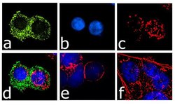 Invitrogen CCR3 Recombinant Superclonal Antibody (23HCLC) 100 &mu;g; Unconjugated:Antibodies,