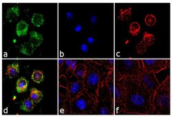 Invitrogen RhoB Recombinant Superclonal Antibody (19HCLC) 100 &mu;g; Unconjugated:Antibodies,
