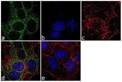 YBX1 Recombinant Polyclonal Antibody (10HCLC), Invitrogen 100 &mu;g; Unconjugated:Antibodies,