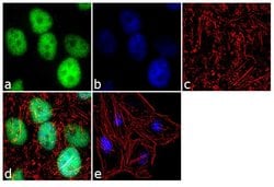 Invitrogen FKBP5 Recombinant Superclonal Antibody (6HCLC) 100 &mu;g; Unconjugated:Antibodies,