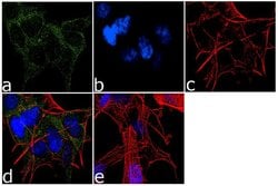 Invitrogen TBK1 Recombinant Superclonal Antibody (10HCLC) 100 &mu;g; Unconjugated:Antibodies,