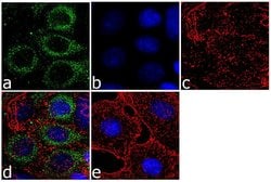Invitrogen WNK1 Recombinant Superclonal Antibody (3HCLC) 100 &mu;g; Unconjugated:Antibodies,