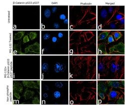 Phospho-beta Catenin (Ser33, Ser37) Recombinant Superclonal Antibody (4HCLC):Antibodies,