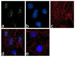 Invitrogen KLF17 Recombinant Superclonal Antibody (7HCLC) 100 &mu;g; Unconjugated:Antibodies,