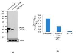 Invitrogen SMYD3 Recombinant Superclonal Antibody 100 &mu;g; Unconjugated:Antibodies,