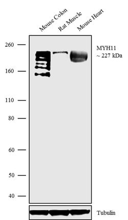 Invitrogen MYH11 Recombinant Superclonal Antibody 100 &mu;g; Unconjugated:Antibodies,