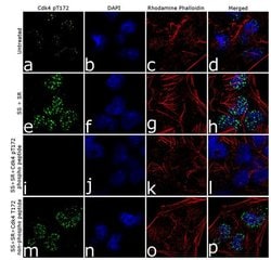 Invitrogen Phospho-CDK4 (Thr172) Recombinant Superclonal Antibody (9HCLC)