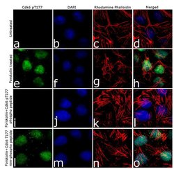 Invitrogen Phospho-CDK6 (Thr177) Recombinant Superclonal Antibody (16HCLC)