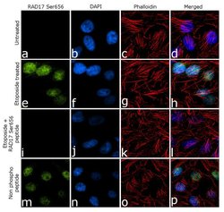 Invitrogen Phospho-RAD17 (Ser656) Recombinant Superclonal Antibody (12HCLC)