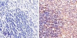 Invitrogen STAT5 beta Polyclonal Antibody 100 &mu;g; Unconjugated:Antibodies,