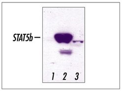 Invitrogen STAT5 beta Polyclonal Antibody 100 &mu;g; Unconjugated:Antibodies,