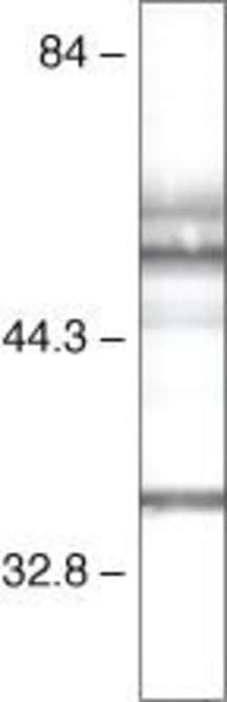 Invitrogen PAX2 Polyclonal Antibody 100 &mu;g; Unconjugated:Antibodies,