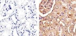 Invitrogen Pan-cadherin Polyclonal Antibody 100 &mu;g; Unconjugated:Antibodies,