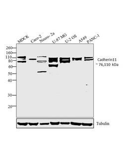 Invitrogen CDH11 Polyclonal Antibody 100 μg; Unconjugated:Antibodies,