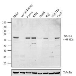 Invitrogen SALL4 Polyclonal Antibody 100 &mu;g; Unconjugated:Antibodies,