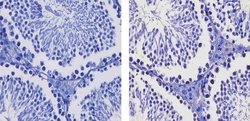 Invitrogen SALL4 Polyclonal Antibody 100 &mu;g; Unconjugated:Antibodies,