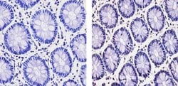 Invitrogen GLIS1 Polyclonal Antibody 100 &mu;g; Unconjugated:Antibodies,