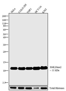 Invitrogen H4K20me2 Polyclonal Antibody 100 &mu;g | Buy Online | Invitrogen&trade; | Fisher Scientific