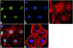 Invitrogen&trade;&nbsp;H3K14ac Polyclonal Antibody