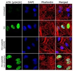 Invitrogen Phospho-ATR (Ser428) Polyclonal Antibody 100 &mu;g; Unconjugated:Antibodies,