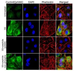 Phospho-Cyclin E (Ser88) Polyclonal Antibody, Invitrogen 100 &mu;g; Unconjugated:Antibodies,