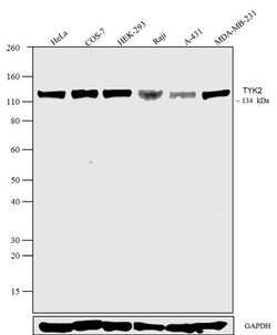 Invitrogen TYK2 Polyclonal Antibody 100 &mu;g; Unconjugated:Antibodies,