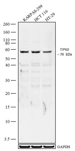TIP60 Polyclonal Antibody:Antibodies, Polyclonal