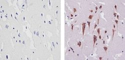 TIP60 Polyclonal Antibody:Antibodies, Polyclonal