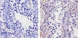 TIP60 Polyclonal Antibody:Antibodies, Polyclonal