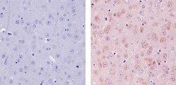 TIP60 Polyclonal Antibody:Antibodies, Polyclonal