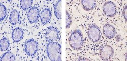 Invitrogen RNF20 Polyclonal Antibody 100 &mu;g; Unconjugated:Antibodies,