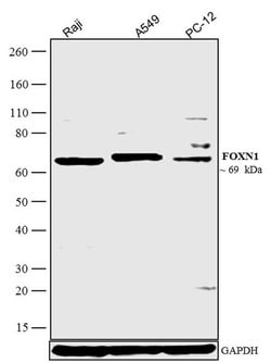 Invitrogen FOXN1 Polyclonal Antibody 100 &mu;g; Unconjugated:Antibodies,