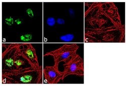 Invitrogen SOX21 Polyclonal Antibody 100 &mu;g; Unconjugated:Antibodies,