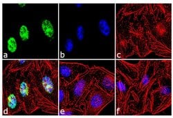 Invitrogen MSX1 Polyclonal Antibody 100 &mu;g; Unconjugated:Antibodies,