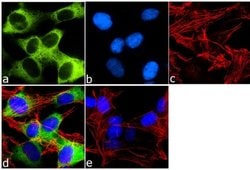 Invitrogen STMN2 Polyclonal Antibody 100 &mu;g; Unconjugated:Antibodies,
