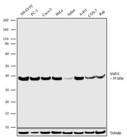 Invitrogen SMN1 Polyclonal Antibody 100 &mu;g; Unconjugated:Antibodies,