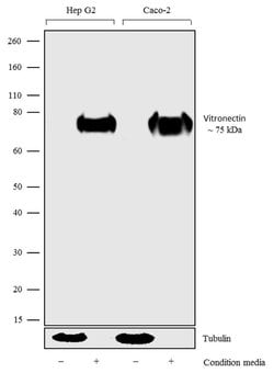 Invitrogen Vitronectin Polyclonal Antibody 100 &mu;g; Unconjugated:Antibodies,