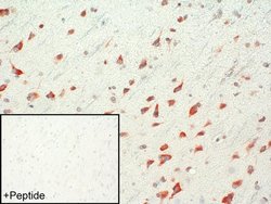 Invitrogen mGluR1 Polyclonal Antibody 100 &mu;g; Unconjugated:Antibodies,