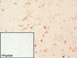 mGluR2 Polyclonal Antibody:Antibodies, Polyclonal