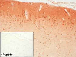 Invitrogen mGluR4 Polyclonal Antibody 100 &mu;g; Unconjugated:Antibodies,