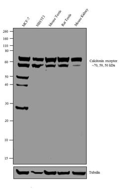 Invitrogen Calcitonin Receptor Polyclonal Antibody 100 &mu;g; Unconjugated:Antibodies,