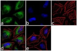 Calcyclin Polyclonal Antibody, Invitrogen 100 &mu;g; Unconjugated:Antibodies,
