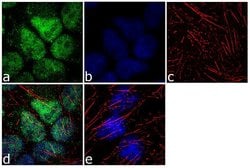 Invitrogen SMAD9 Polyclonal Antibody 100 &mu;g; Unconjugated:Antibodies,