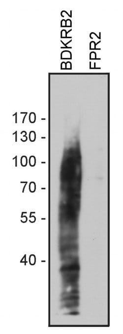 BDKRB2 Polyclonal Antibody, Invitrogen 100 &mu;g; Unconjugated:Antibodies,