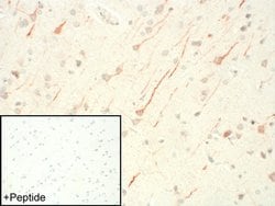 FPR1 Polyclonal Antibody:Antibodies, Polyclonal