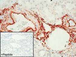 FPR2 Polyclonal Antibody:Antibodies, Polyclonal